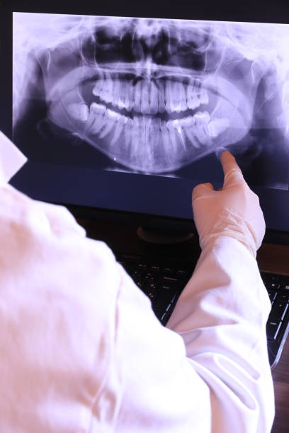 Best Emergency Dentist for Knocked-Out Tooth in Martha Lake, WA